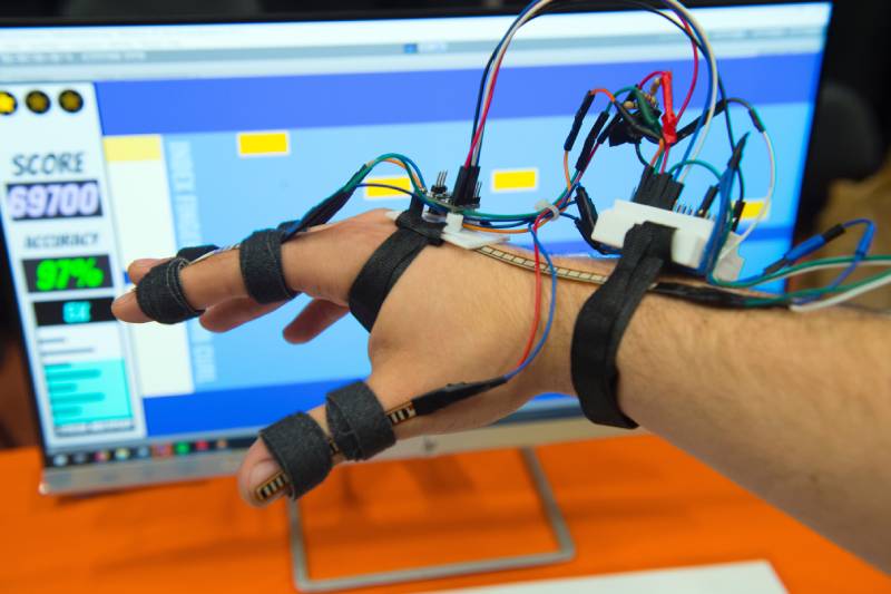 Forearm and hand with diagnostic equipment attached