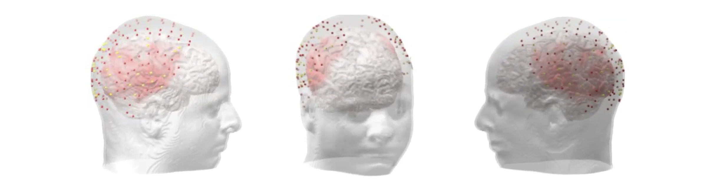 Graphic of see through head with brain and activation points visible