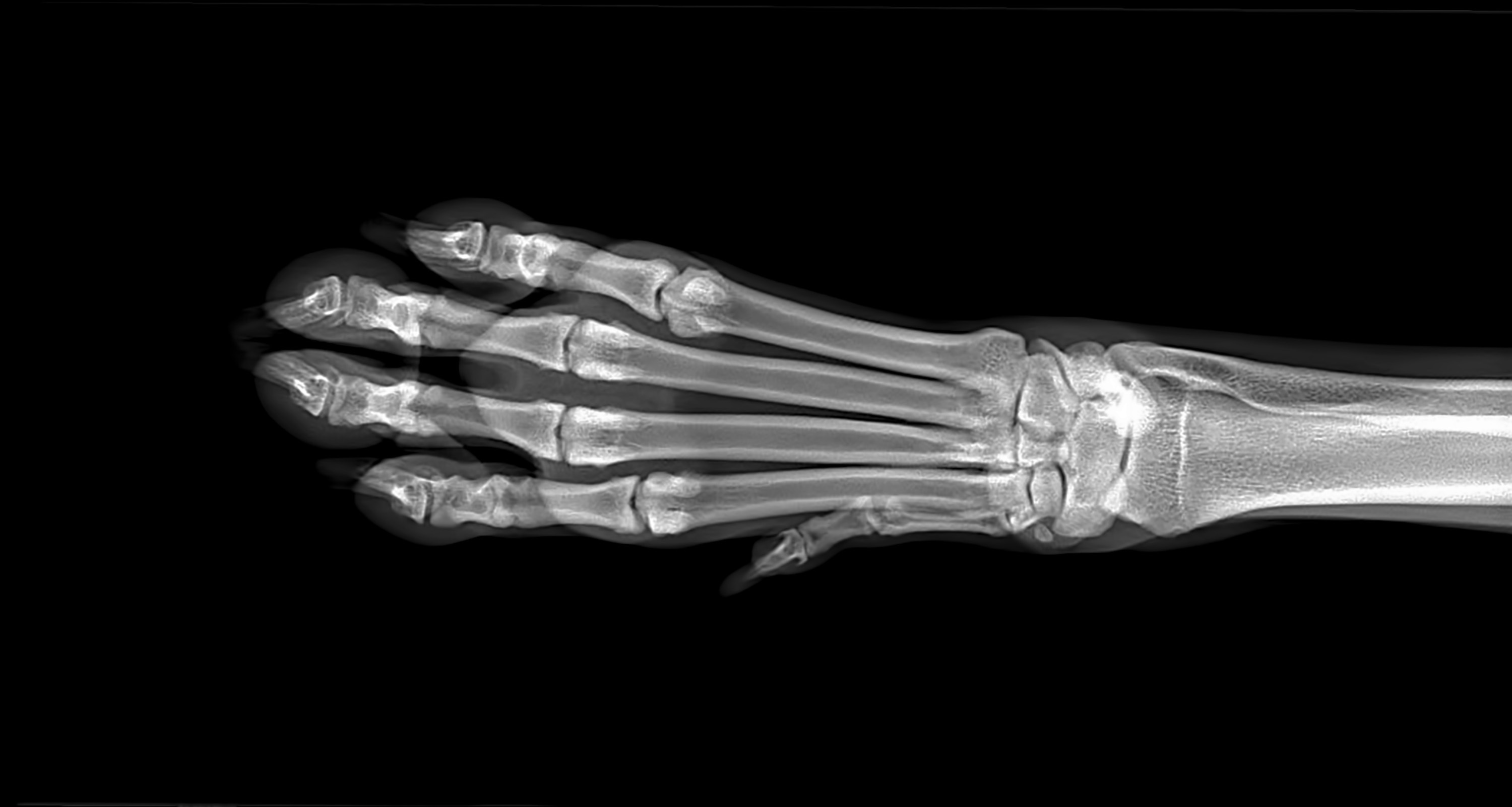 an x-ray of bones