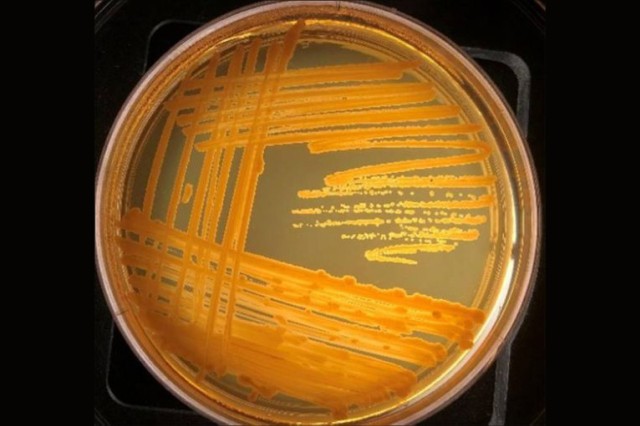 Petri dish showing orange zigzags of bacteria growth.