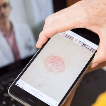a person taking a photo of a spot on their skin with a smartphone.