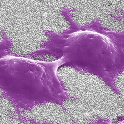cells sitting on top of a carbon nanotube.