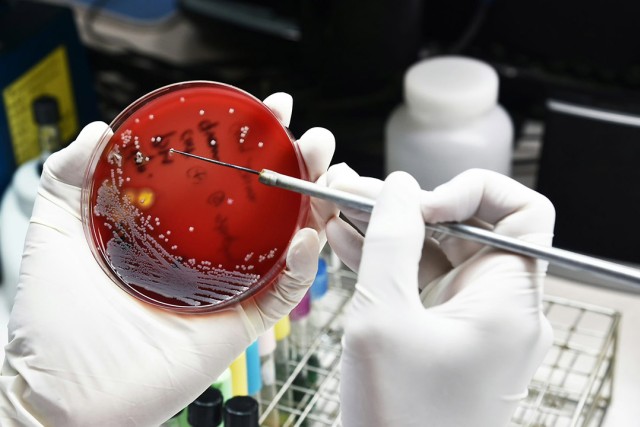 a red petri dish with white lines and dots of bacteria growing in it.