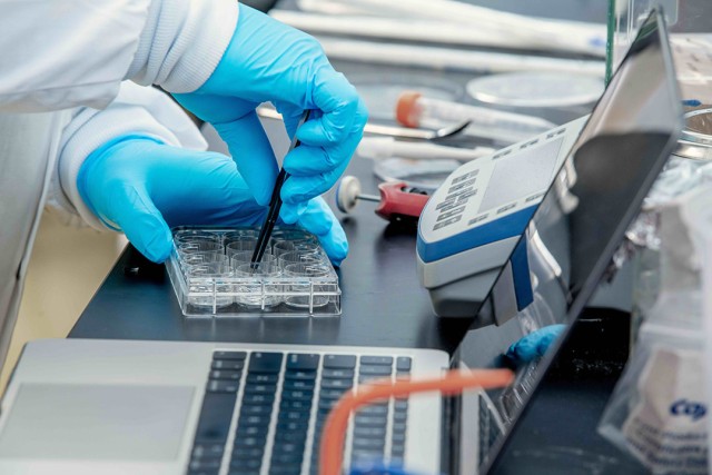 gloved hands use tweezers to remove an item from a case.