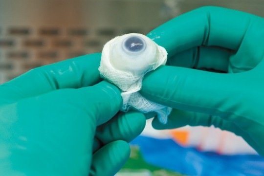 image of eyeball in gauze.