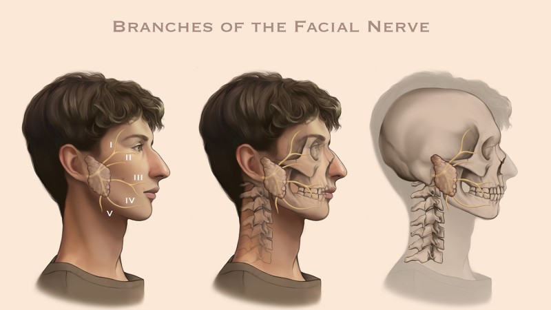 Three side by side images of a skeleton and a person to visually represent the anatomy of the facial nerve.