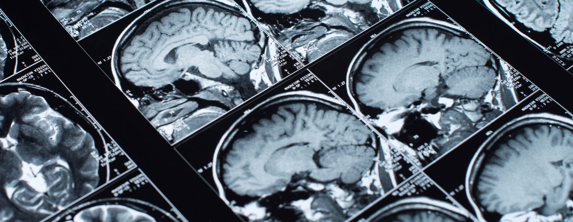 Magnetic resonance