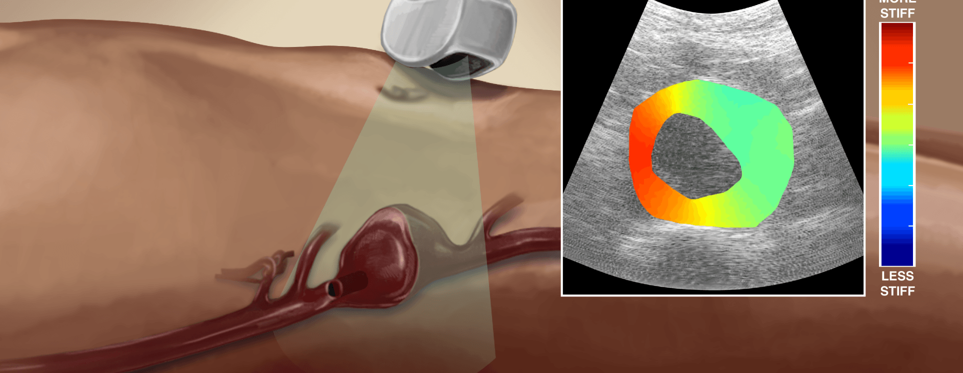 illustration of an abdominal ultrasound with sonogram.
