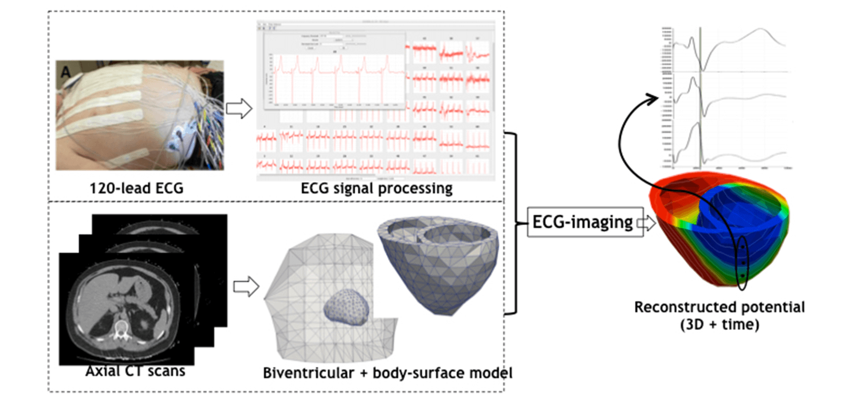 models showing E C G data.