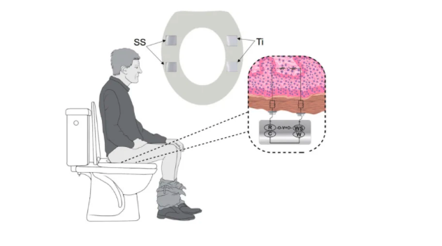 Skin Electrode Contact Impedance on Commode
