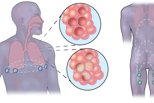 Respiration monitoring via back of thigh