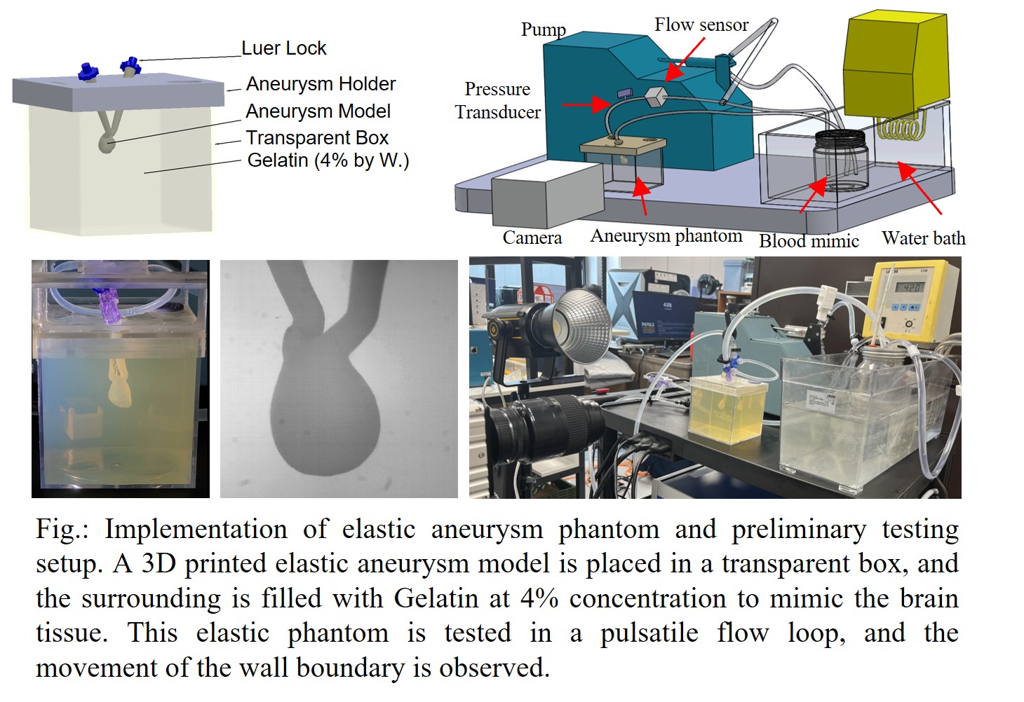 An instrument for measuring a cerebral aneurysm.