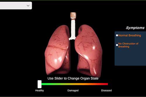 Interactive 3D lung model showing healthy to diseased states with a slider and breathing symptoms legend.