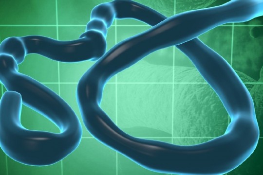 Graphic of ebola virus.