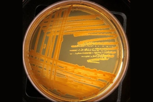 Petri dish showing orange zigzags of bacteria growth.