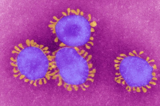 purple and yellow microscopic image of coronavirus.