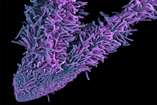 Purple, snake-like structures forming a V-shape against a stark, black background.