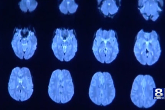 a cat scan of a brain is shown repeated across the screen.