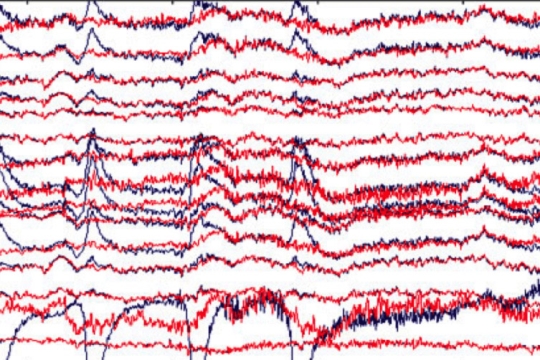 blue and red lines are shown on a screen, representing E E G data.