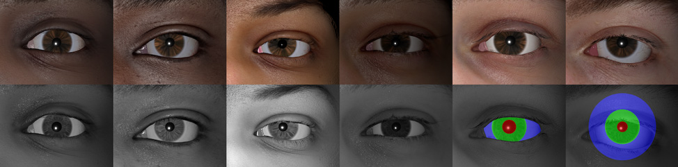 Up-close photos of eyeballs.