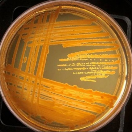Petri dish showing orange zigzags of bacteria growth.