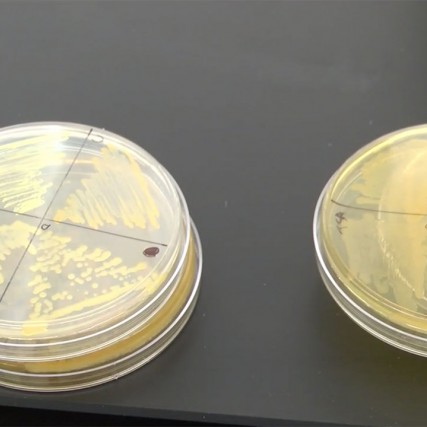 Petri dishes filled with bacteria samples