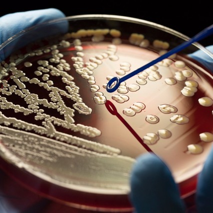 petri dish with bacteria growing.