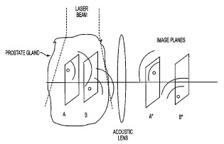 Representative figure for patent 8,870,770