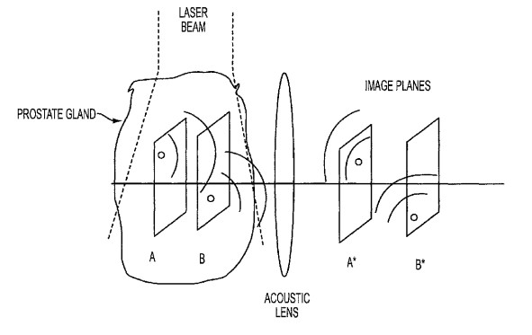 Representative figure for patent 8,353,833