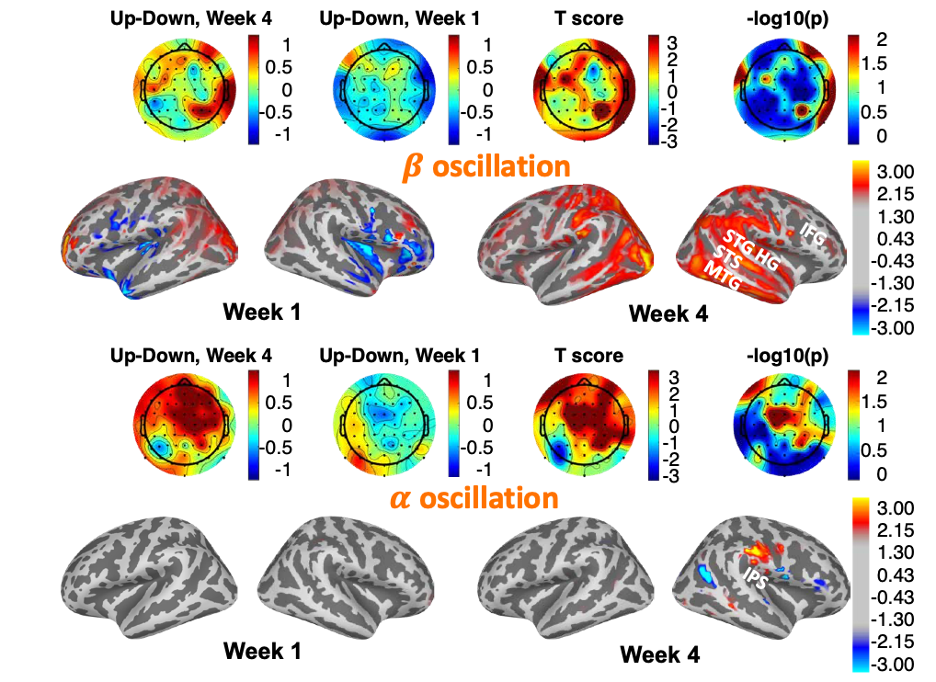 alpha and beta oscillation during auditory attention
