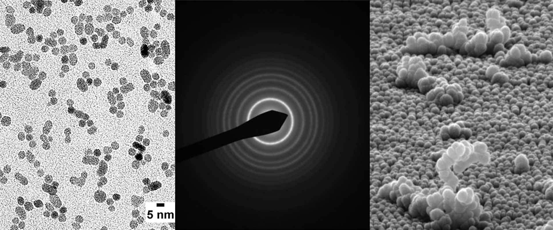 collage of three black and white images taken with an electron microscope.