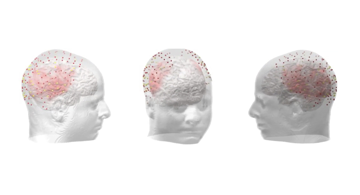 Graphic of see through head with brain and activation points visible