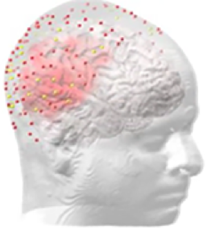 Image of head with red section highlighted and red dots over surface.