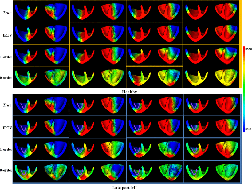 Transmural Electrophysiological Imaging to Guide Catheter Ablation of Arrhythmias Diagram