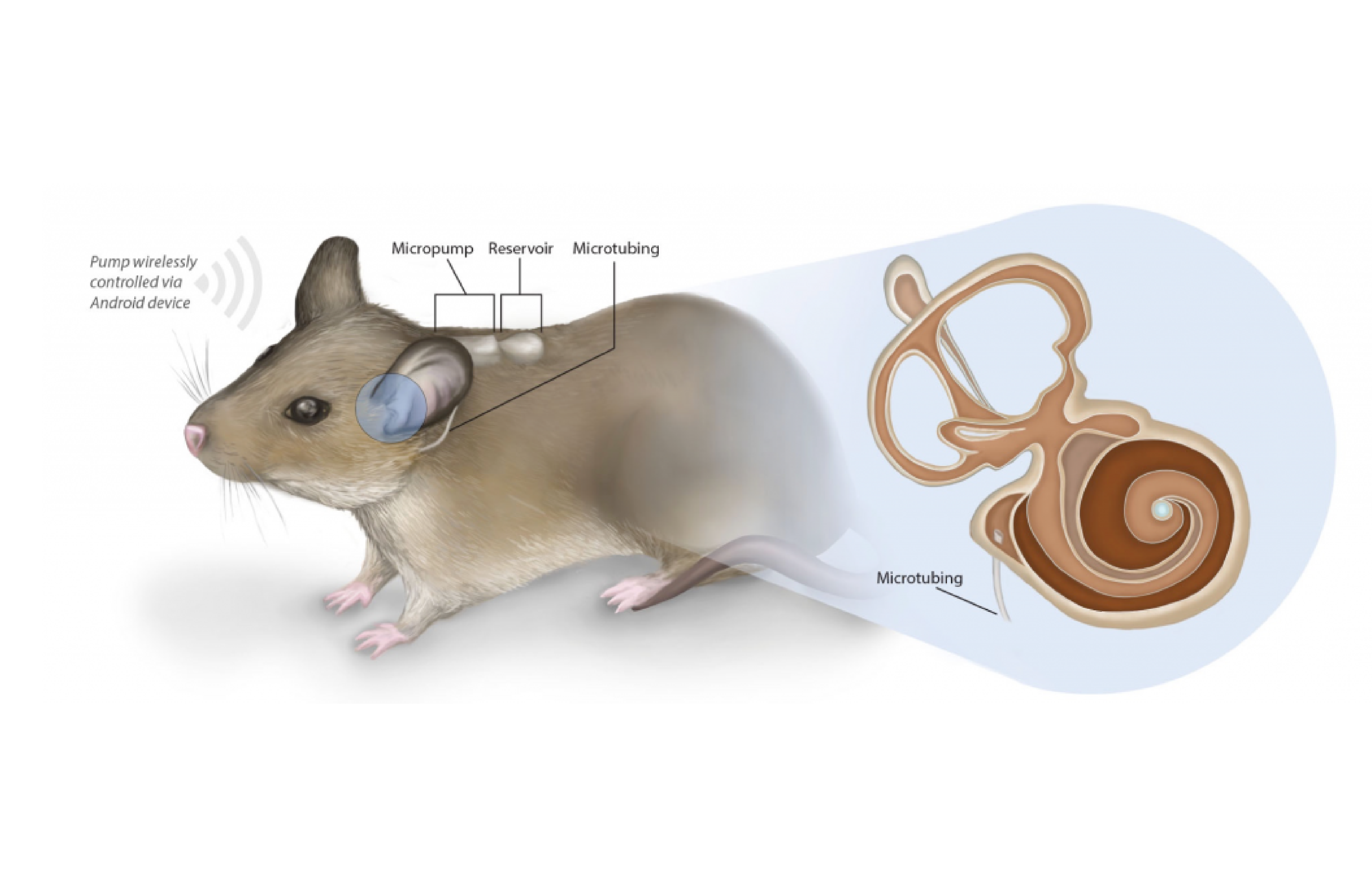 Auditory Dysfunction Therapies