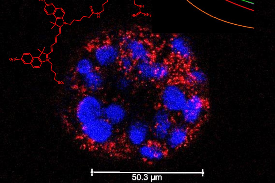 photos of targeted molecular imaging agents (TMIAs) on MRI scan