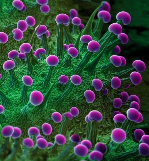 a color photographic image taken through a microscope of the plant structure with purple lobes on a green background. 