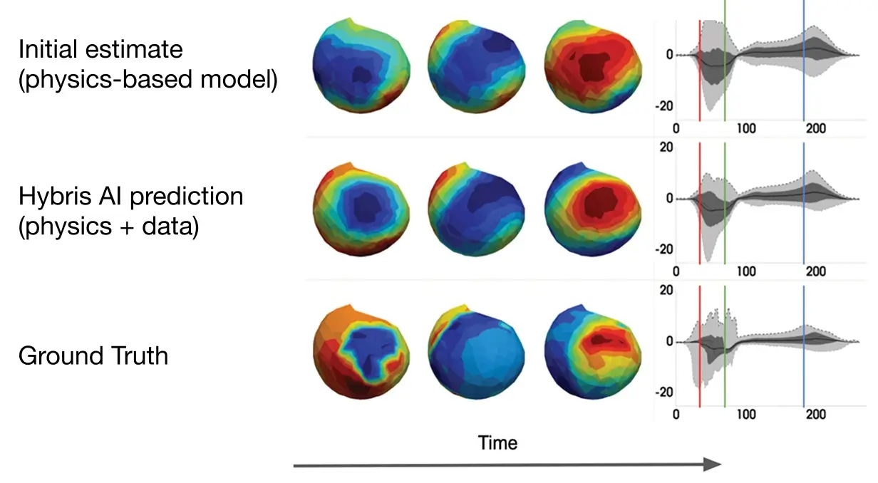Images representing how electrical signals propagate across heart muscles, while waveform plots show how the timing and shape of the electrical signals differ between the physics-based model, the hybrid AI model, and the real-world data.