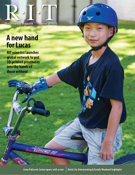 Boy on bicycle wearing 3D-printed prosthetic
