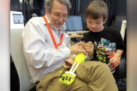 People working on prosthetics arm