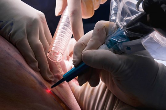 Doctors working on patient