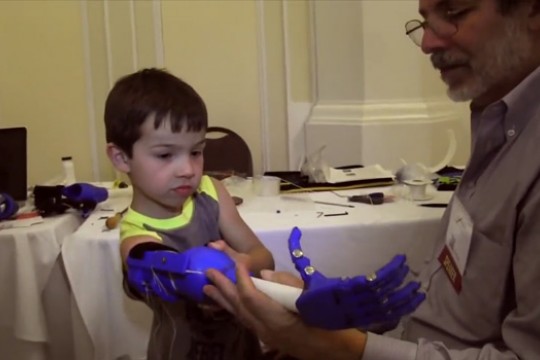 Child with prosthetic arm 