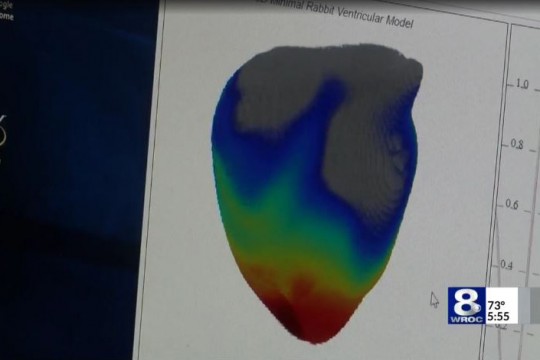 Image of human heart on computer screen.