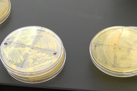 Petri dishes filled with bacteria samples
