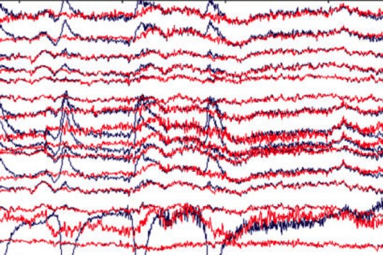 blue and red lines are shown on a screen, representing E E G data.