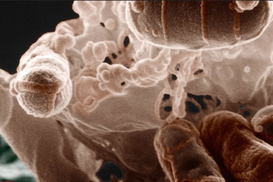 Microscopy image of a cluster of pill-shaped blobs on a rugged surface against a black background