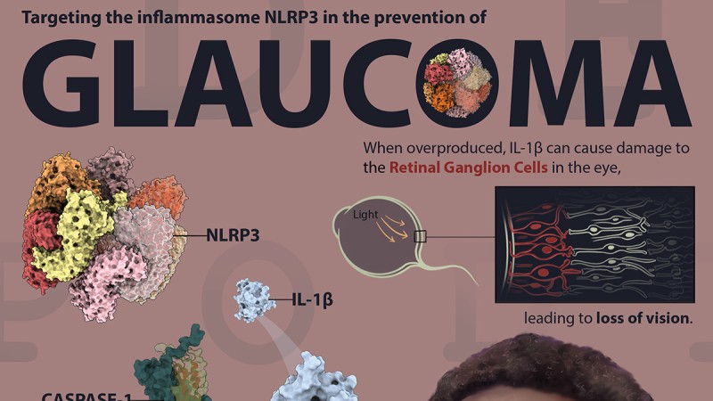 An illustration of the science of glaucoma.