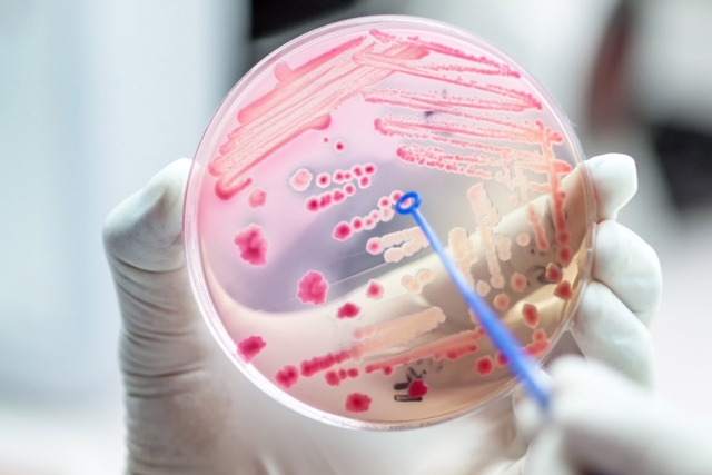 pink bacteria is shown in a slide behind held by a white gloved hand