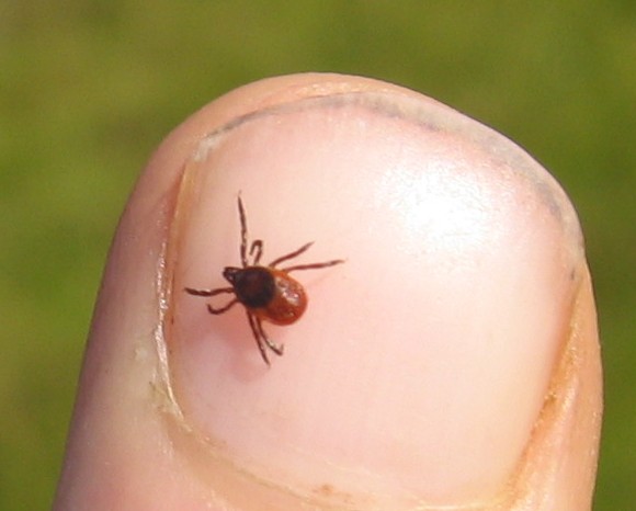a photo of a deer tick on a white person's finger nail