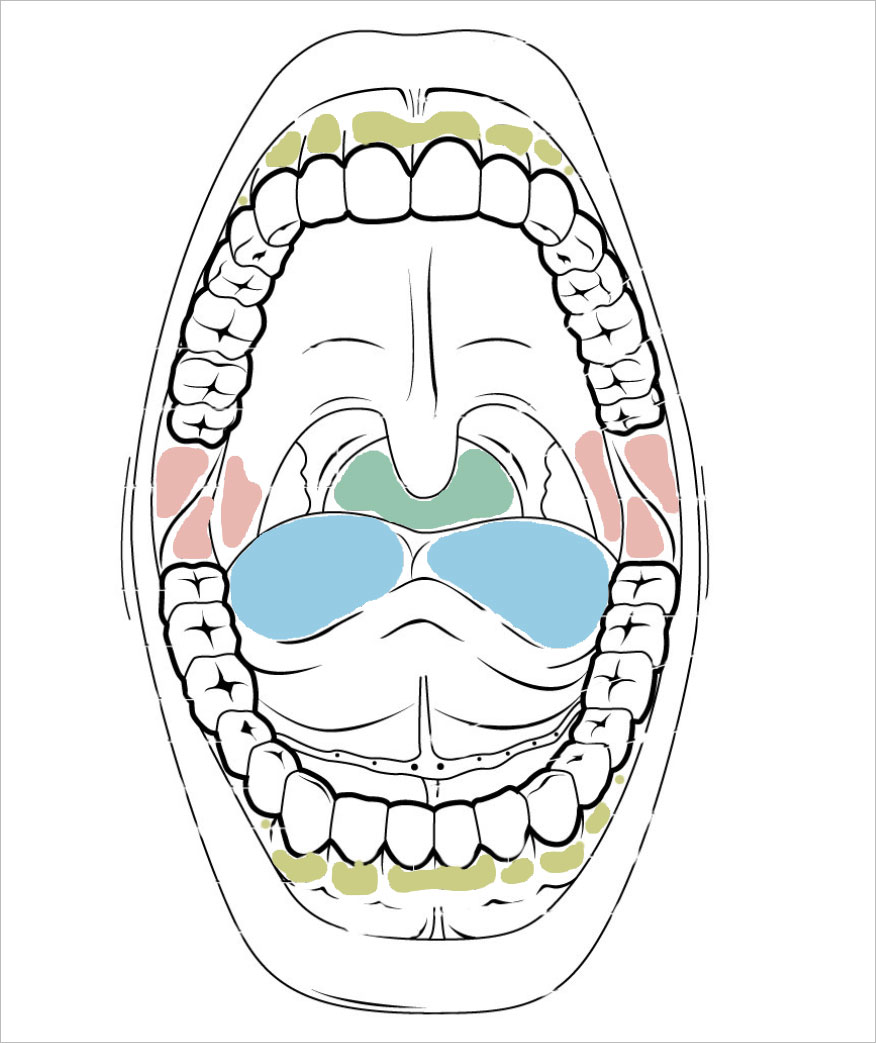 Color-coded diagram of mouth showing locations of various Neisseria species colonization across oral regions.